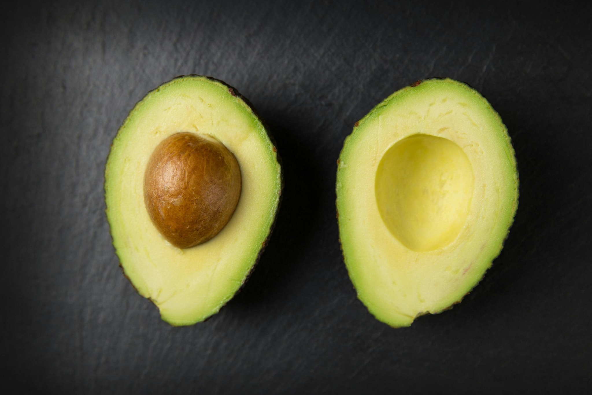 Avocados: Rich in healthy fats and B vitamins, avocados support brain function and help regulate mood. 