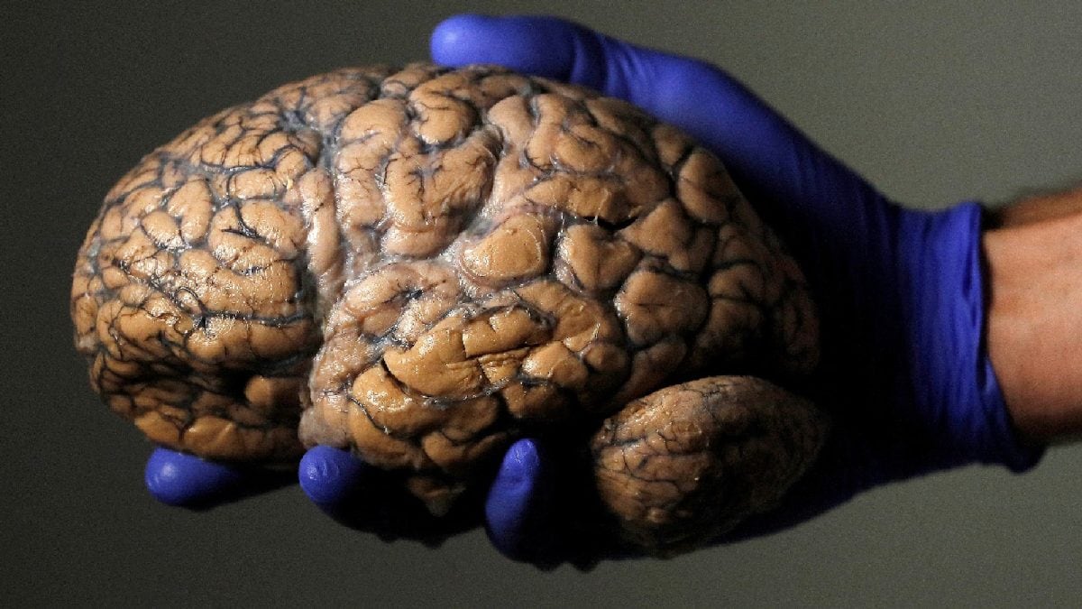 New Research Shows Adulthood Starts After 32 As Scientists Shed Light On Five Phases Of Human Brain