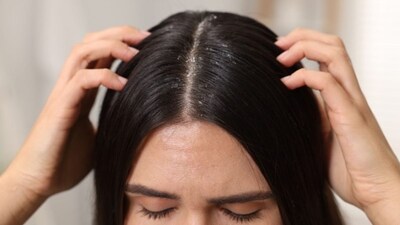 Neglecting scalp care can lead to itchiness and dandruff. 