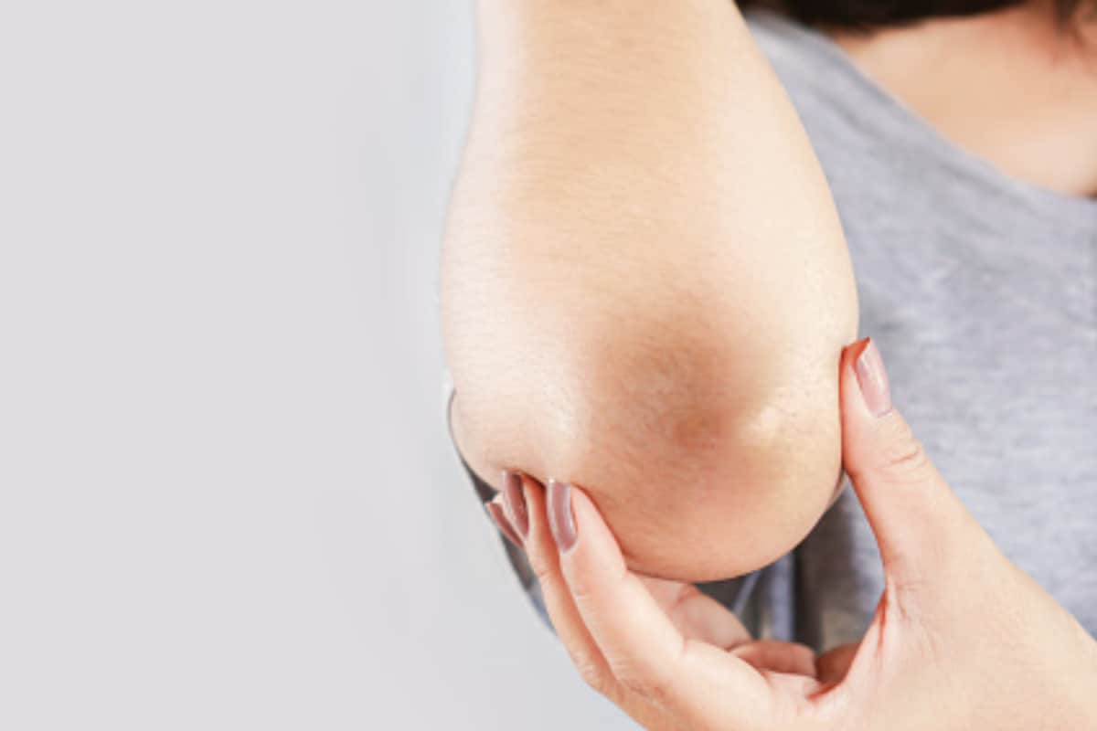 Struggling With Dark Elbows? Try These Easy DIY Fixes For Quick Results