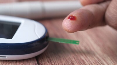 Doctors flag dark neck patches as a sign of insulin resistance