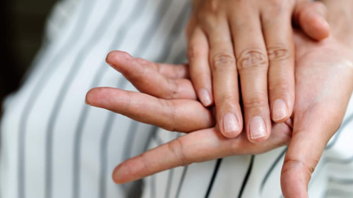 Feelings Tingles In Hands & Feet? These Are Early Signs Of Nerve Damage Or Vitamin B12 Deficiency