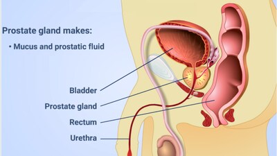 How early detection and modern therapies are improving outcomes for men with prostate cancer.