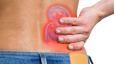 Women over 40 need to pay close attention to kidney health. Doctors warn that common habits like painkiller misuse, poor hydration and diet choices can silently damage kidneys over time.