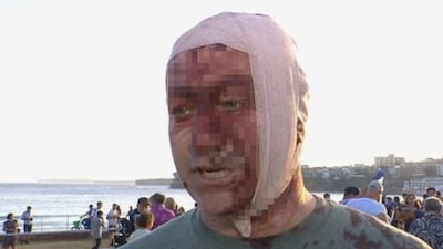 The man, who has not been identified, said he had lived in Israel for the last 13 years and had survived the October 7 attacks there in 2023. (Daily Mail/X)