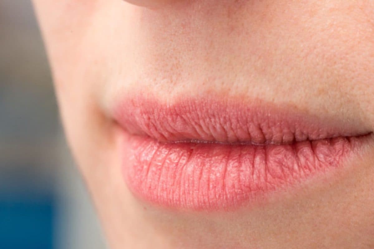 Winter Care Tips: Know How This Age-Old Home Remedy Keeps Lips Soft And Nourished