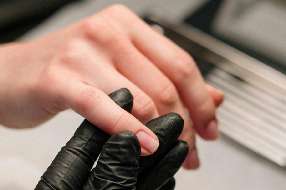 Nails Signalling Health Issues? Doctor Reveals 5 Changes In Your Nails You Shouldn’t Ignore