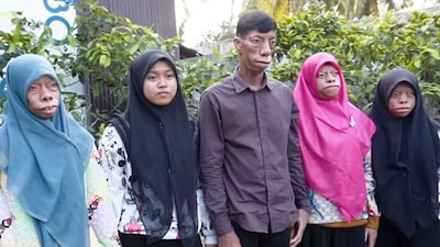 They were made fun of previously but now, they inspire many.(Photo Credit: Youtube)