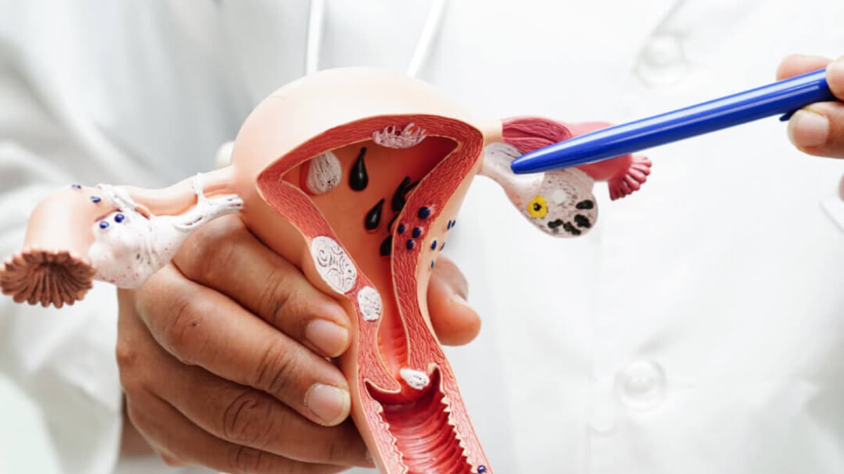 A Simple Test That Can Save Lives: What Every Woman Should Know About Cervical Cancer