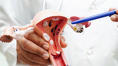 The cervix is the lower part of the uterus, and taking proper care of it can help prevent serious conditions such as cervical cancer.