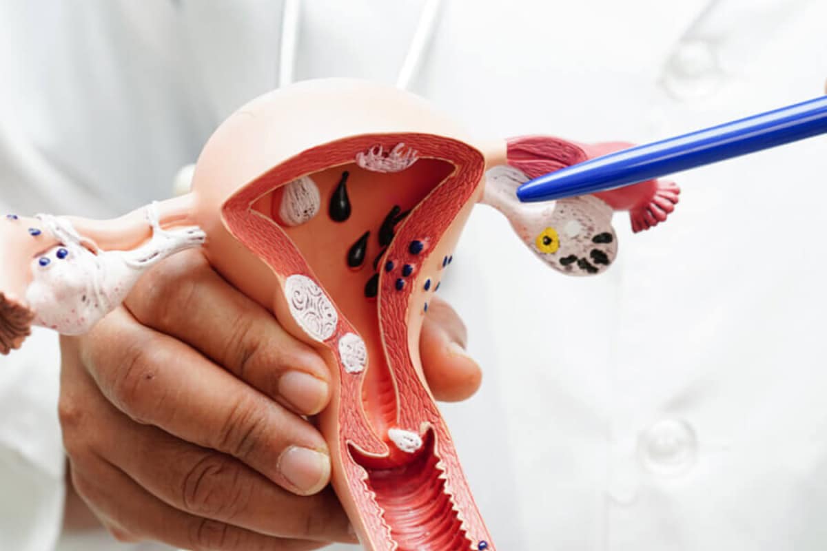 Your 20s Are Crucial: What Every Woman Should Do to Lower Cervical Cancer Risk