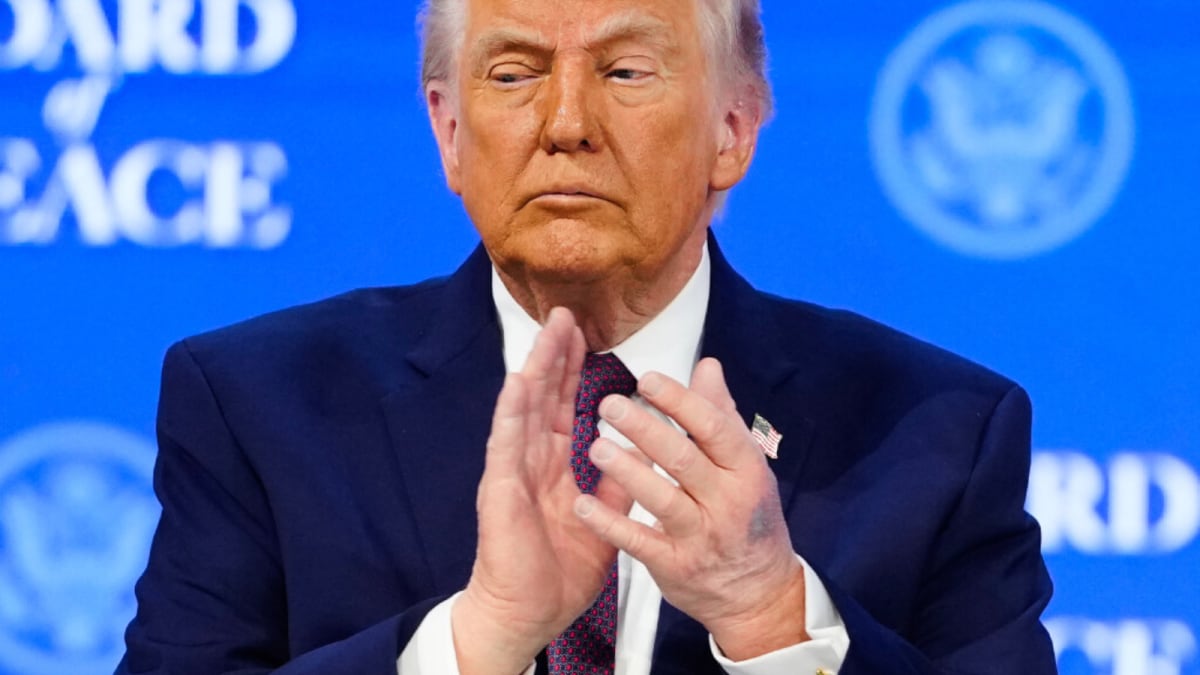 What Is That Blue Bruise On Donald Tump's Hand? US President Breaks His Silence | Watch