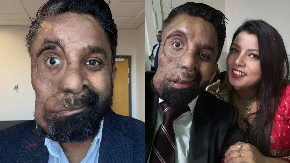 Man with Rare Condition Faces Insensitivity Despite 26 Surgeries