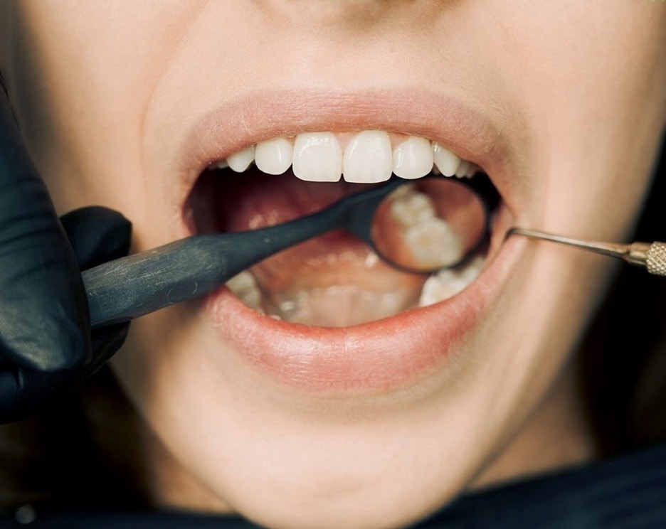 Can A 20-Minute Patch Really Grow New Teeth? Here Is The Truth