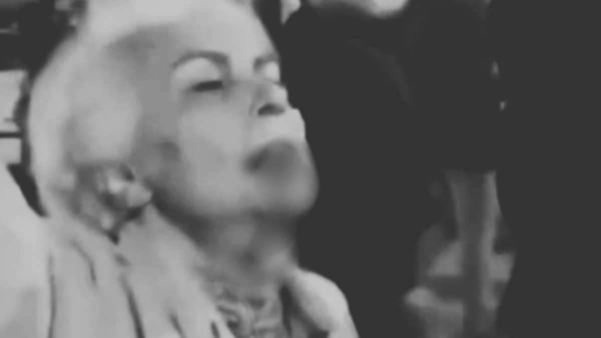 'Been Dead For 47 Years': Woman’s Bloody Protest Video Captures Anger On Iran’s Streets