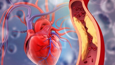 Heart attacks can show warning signs up to a month in advance, including chest pain, dizziness, excessive sweating, fatigue, indigestion, irregular heartbeat, leg swelling, and body pain.