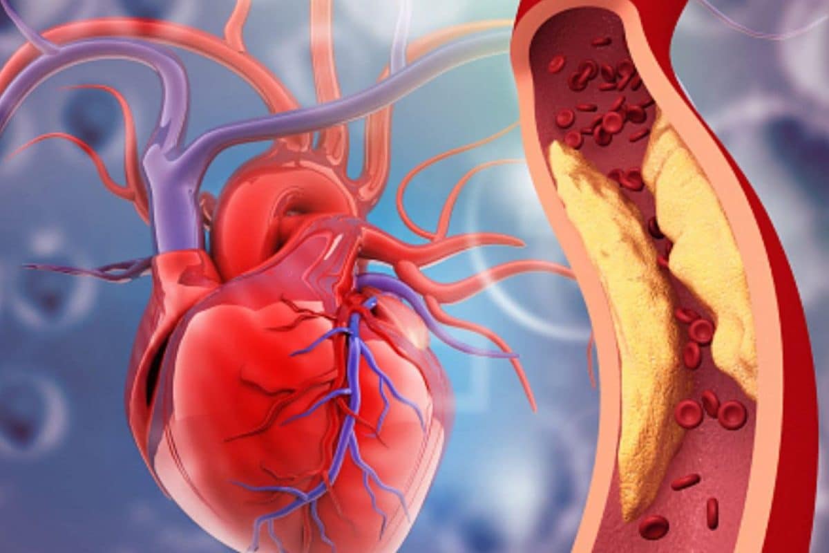 8 Early Warning Signs Of A Heart Attack That Can Appear Weeks Before