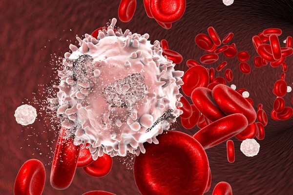 5 Reasons Why Blood Cancers Like Leukaemia, Lymphoma & Myeloma Go Unnoticed