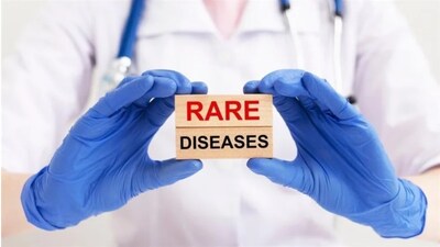 Persistent fatigue, joint pain, and skin rashes may be early warning signs of rare diseases like lupus, says Dr. Bharesh Dedhia, highlighting the need for timely diagnosis.