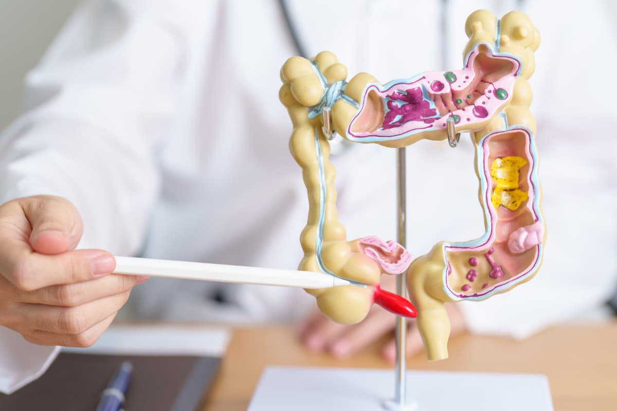 Why Early-Onset Colorectal Cancer Is Rising Among Younger Adults: Lifestyle, Diet And Obesity Risks Explained
