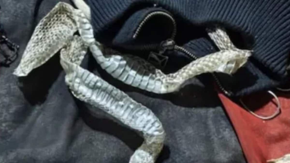 UP Woman Disappears Overnight, 'Snake Skin' Found On Her Bed In Morning