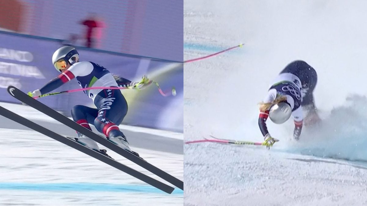 Vonn Left Broken: US Skiing Legend Undergoes Surgery After Horror Crash At Milano-Cortina Games