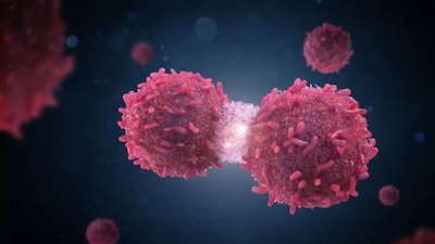 Rare cancers are not always preventable, but delayed diagnosis is often avoidable. Listening to your body, seeking timely care, and trusting clinical expertise remain the most effective safeguards.