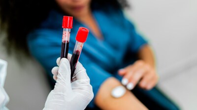 Cancer remains one of the leading causes of death globally, with millions of new diagnoses each year. (Image: Getty)