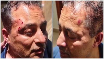 Road Rage Horror: Army Veteran Dragged From Car, Beaten in Gurugram (Photo: Screengrab from X video)