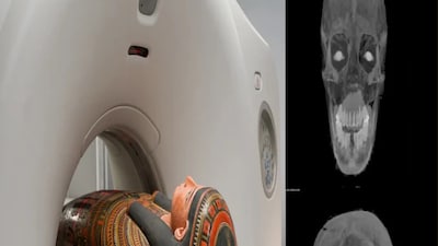 Scientists were surprised to see that even in ancient times, humans faced back pain, joint issues, and dental problems, showing the human body’s vulnerabilities have persisted for millennia. (File Photo)