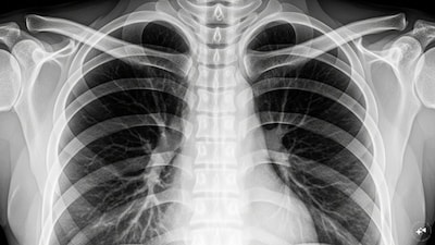 Representative Image. (AI Generated)