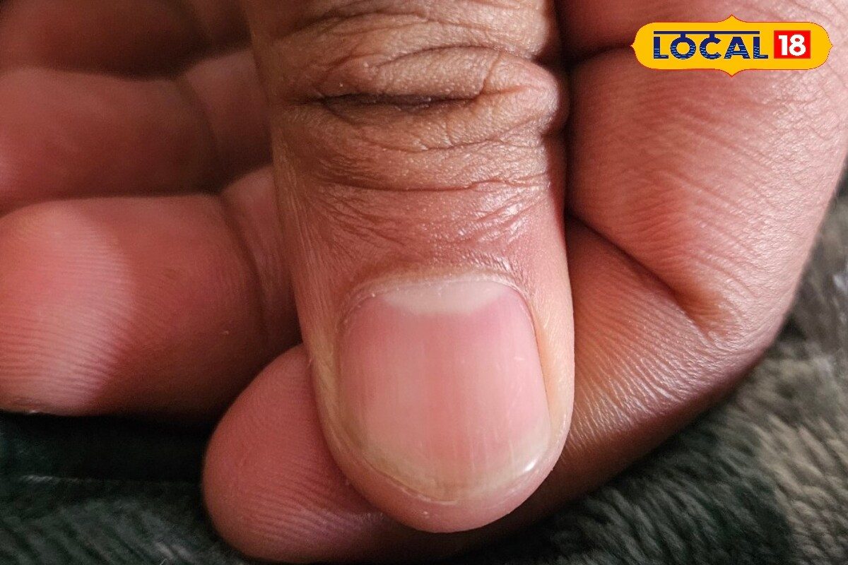 Think White Nail Spots Mean Calcium Deficiency? Here’s What They Could Really Mean