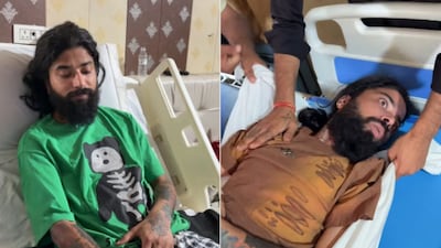 Anurag Dobhal shared a worrying health update after his accident.