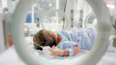 After three cycles of treatment, the tumour had reduced by 90%. The baby not only survived but also retained his eye and vision. (Image: Canva, Representational) 