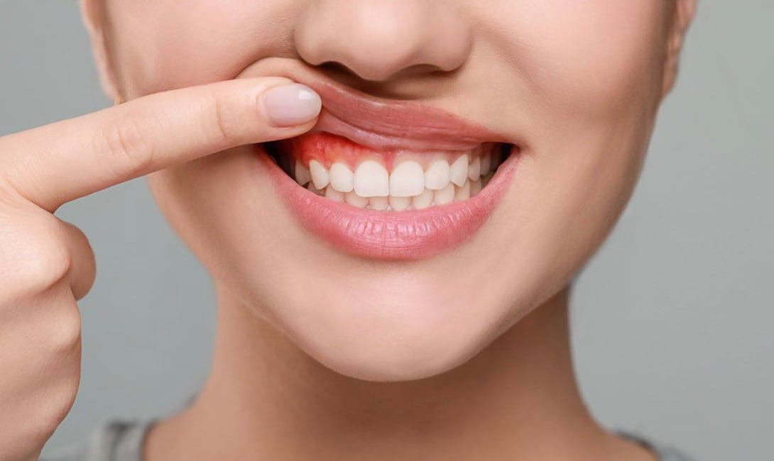 Lowers Risk of Diabetes Complications: People with diabetes are more prone to gum infections, which can make blood sugar harder to control. Flossing helps reduce gum inflammation, supporting better overall management of diabetes.