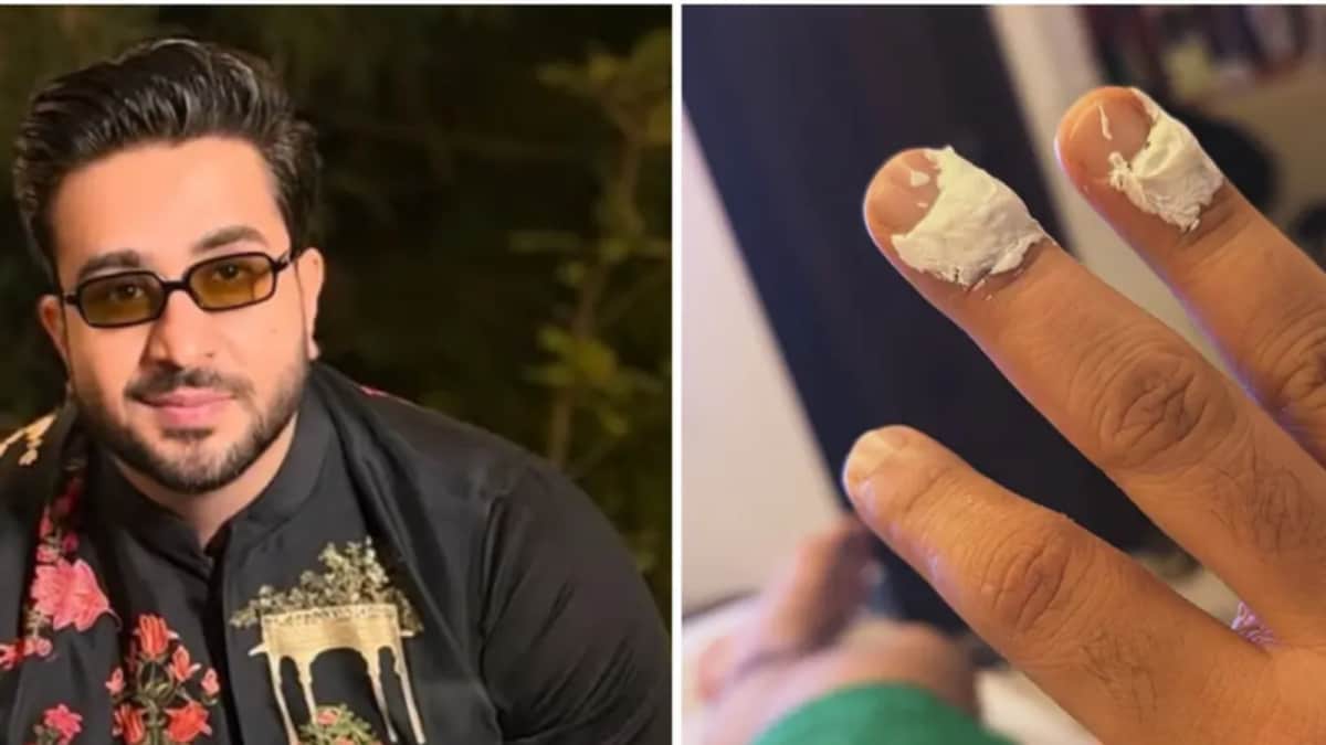 Aly Goni Suffers Minor Burn On Laughter Chefs 3 Set: ‘Pakode Ki Jagah, Haat Fry Kar Diya’ | Television News