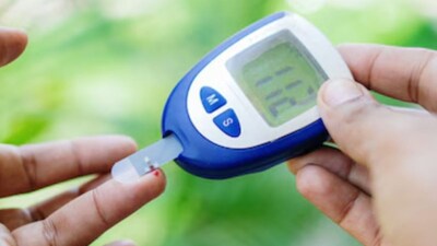 Dr V Mohan is a globally renowned diabetologist and Padma Shri awardee. (Representative Image)