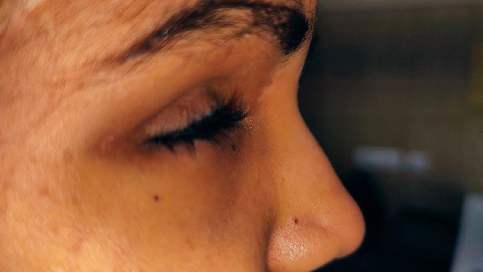 Women At The Helm: How A 19-Year-Old Accident Survivor Rebuilt Her Confidence After Losing An Eye