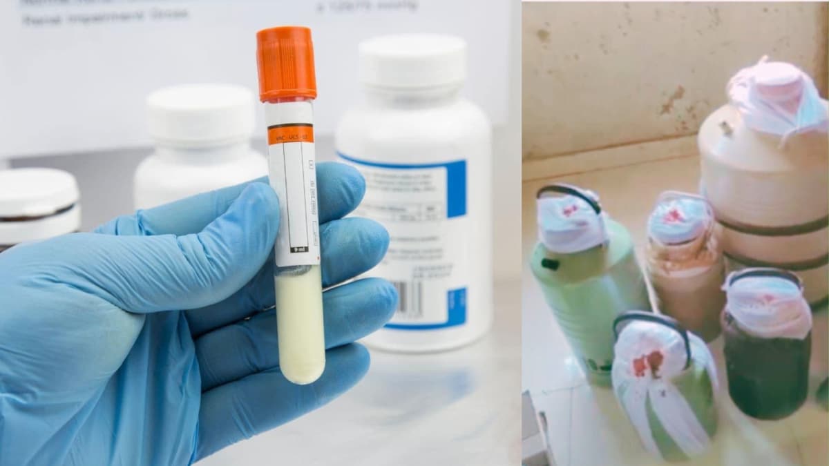 Sperm Smuggling Racket Busted Near Mumbai, Samples Were Being Sold To Doctors For Profit