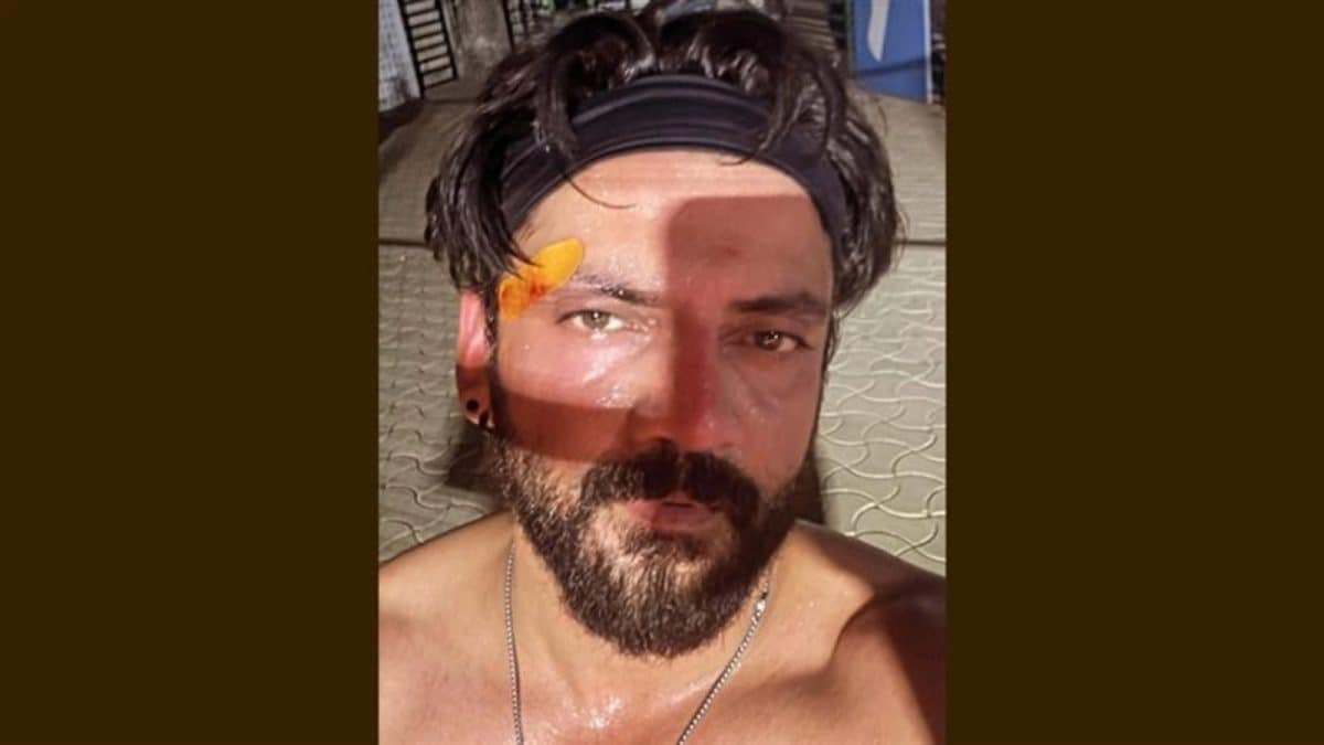 Eyebrow Ouch! How Zaheer Iqbal’s First Padel Slip Became a Bandaged Drama