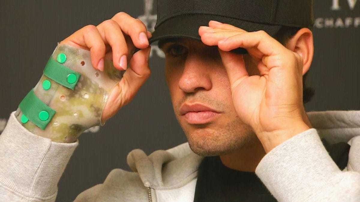 When Will Carlos Alcaraz Return To Action? Potential Comeback Outlined - Report