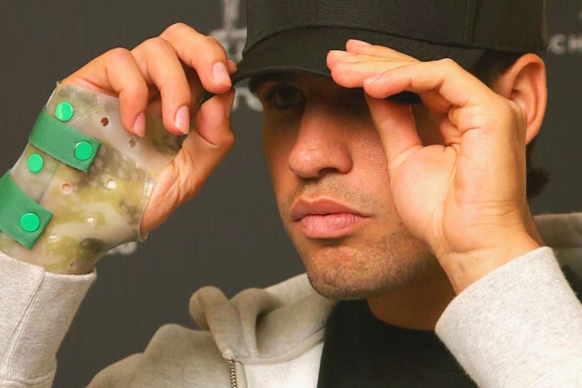 When Will Carlos Alcaraz Return To Action? Potential Comeback Outlined - Report