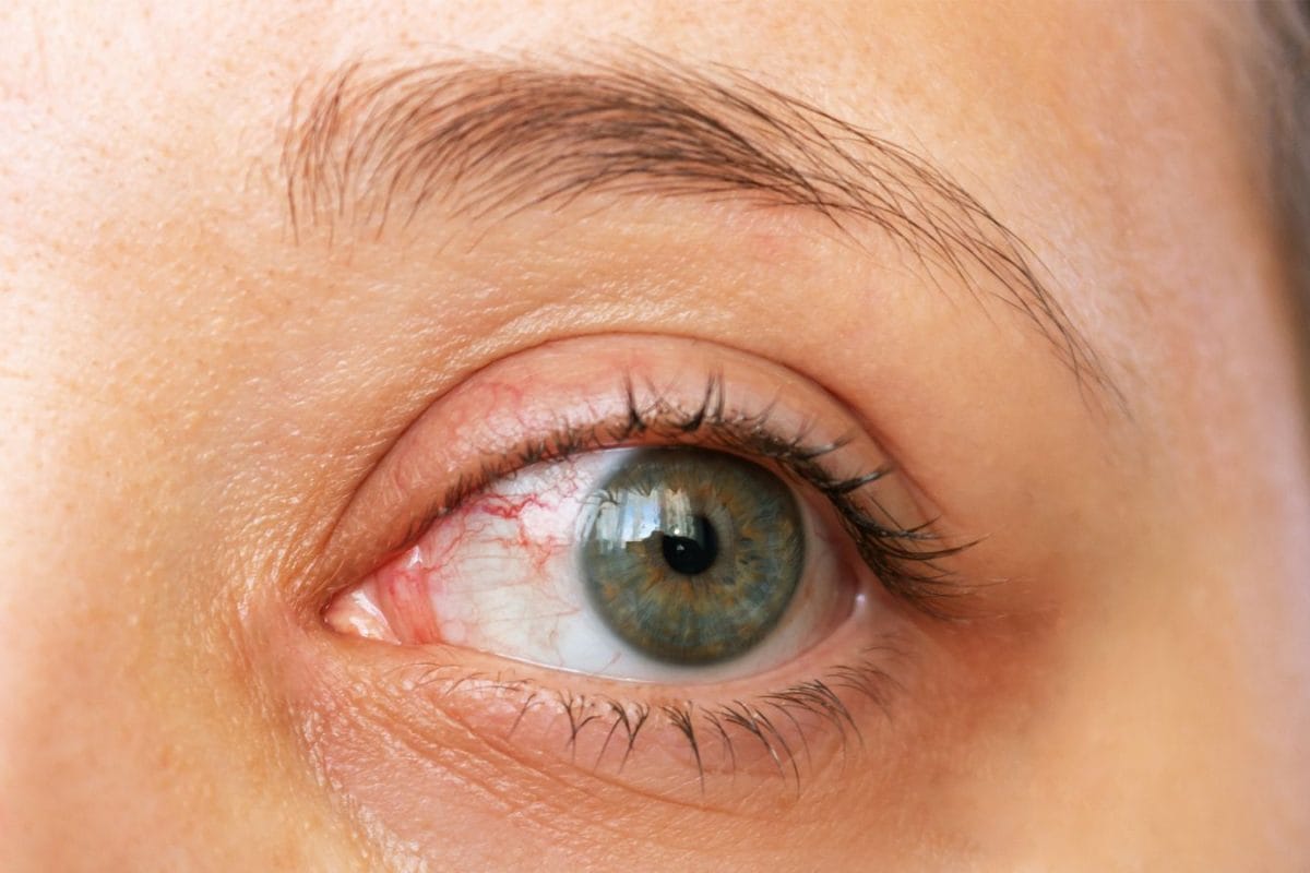 Experiencing Blurred Vision During Screen Use? Here Are 5 Reasons For It