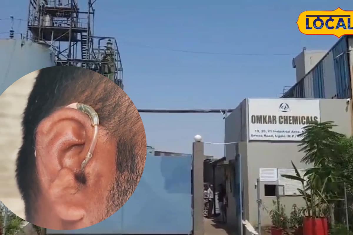 Ujjain’s ‘Silent Poison’ Shock: Over 30 Workers Report Hearing Loss At Chemical Plant