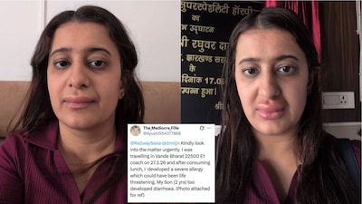 'My Son Developed Diarrhoea': Mother Shares Viral Photos Of Swollen Face After Eating Vande Bharat Lunch