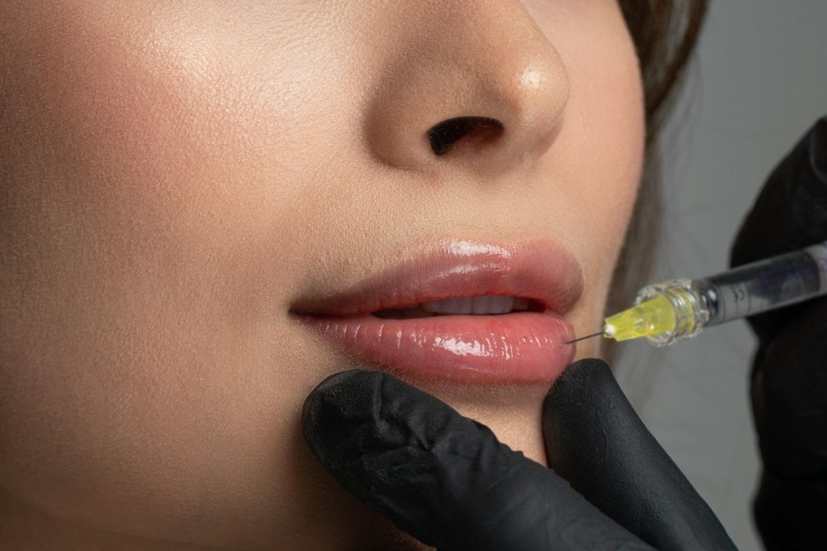 Flip, Lift And Filler: 3 New Lip Treatments Trending Among Indian Beauty Lovers