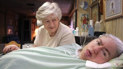 This Teenager Slept For Four Decades In One Of History’s Longest Coma ...