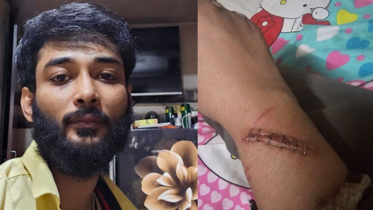 Mumbai Shocker: Husband Forces Wife Into ‘Murga’ Punishment For 4 Hrs, Threatens Acid Attack; Arrested