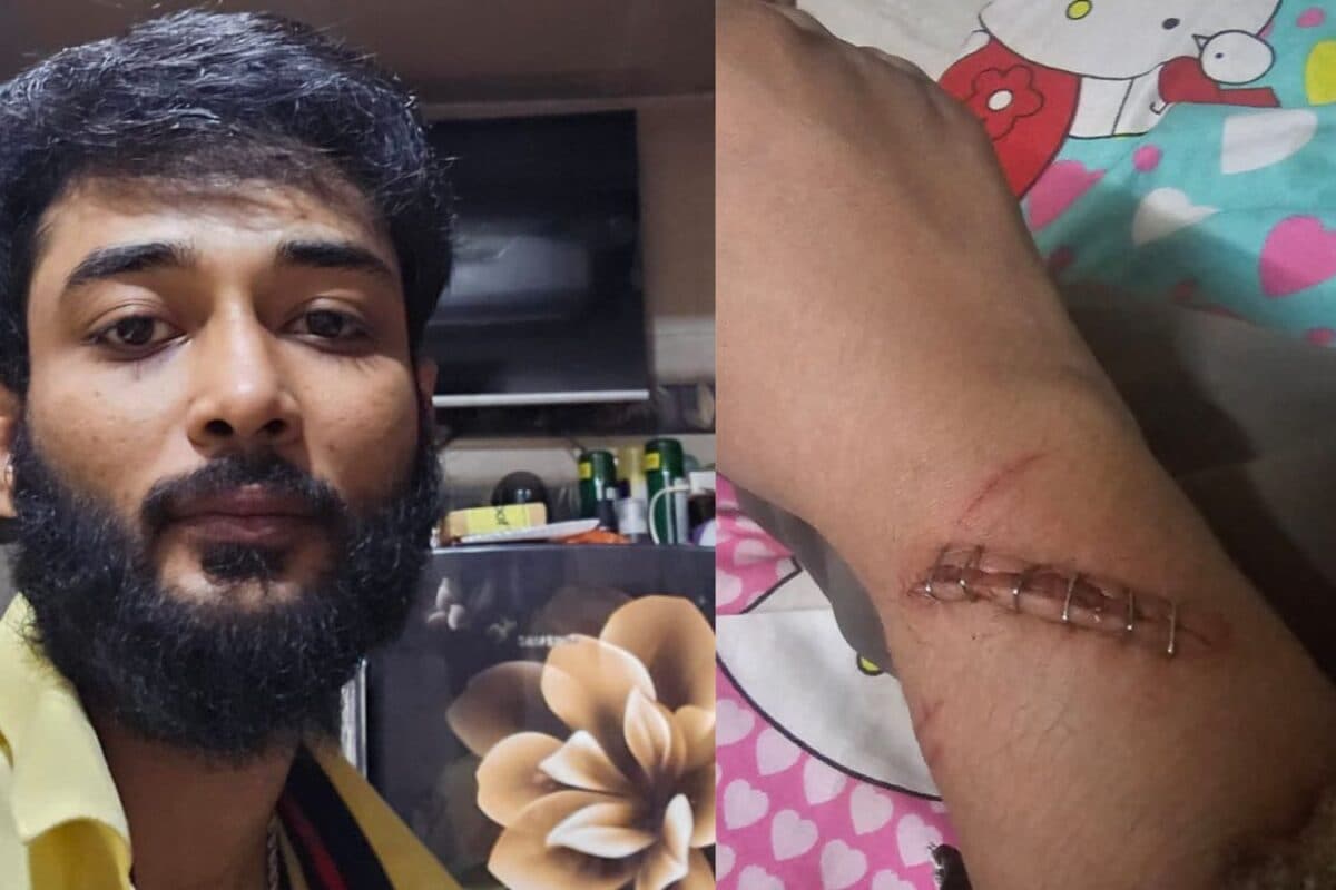Mumbai Shocker: Husband Forces Wife Into ‘Murga’ Punishment For 4 Hrs, Threatens Acid Attack; Arrested
