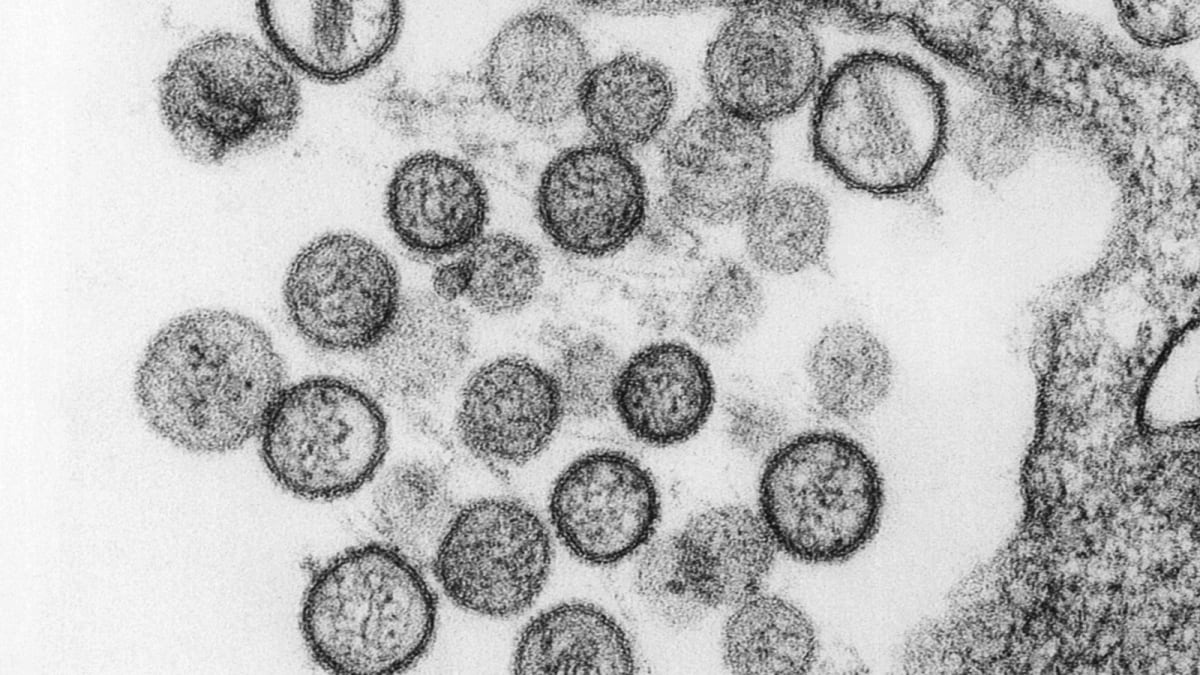 What Is Hantavirus? Why Cruise Ship Cases Are Raising Alarm